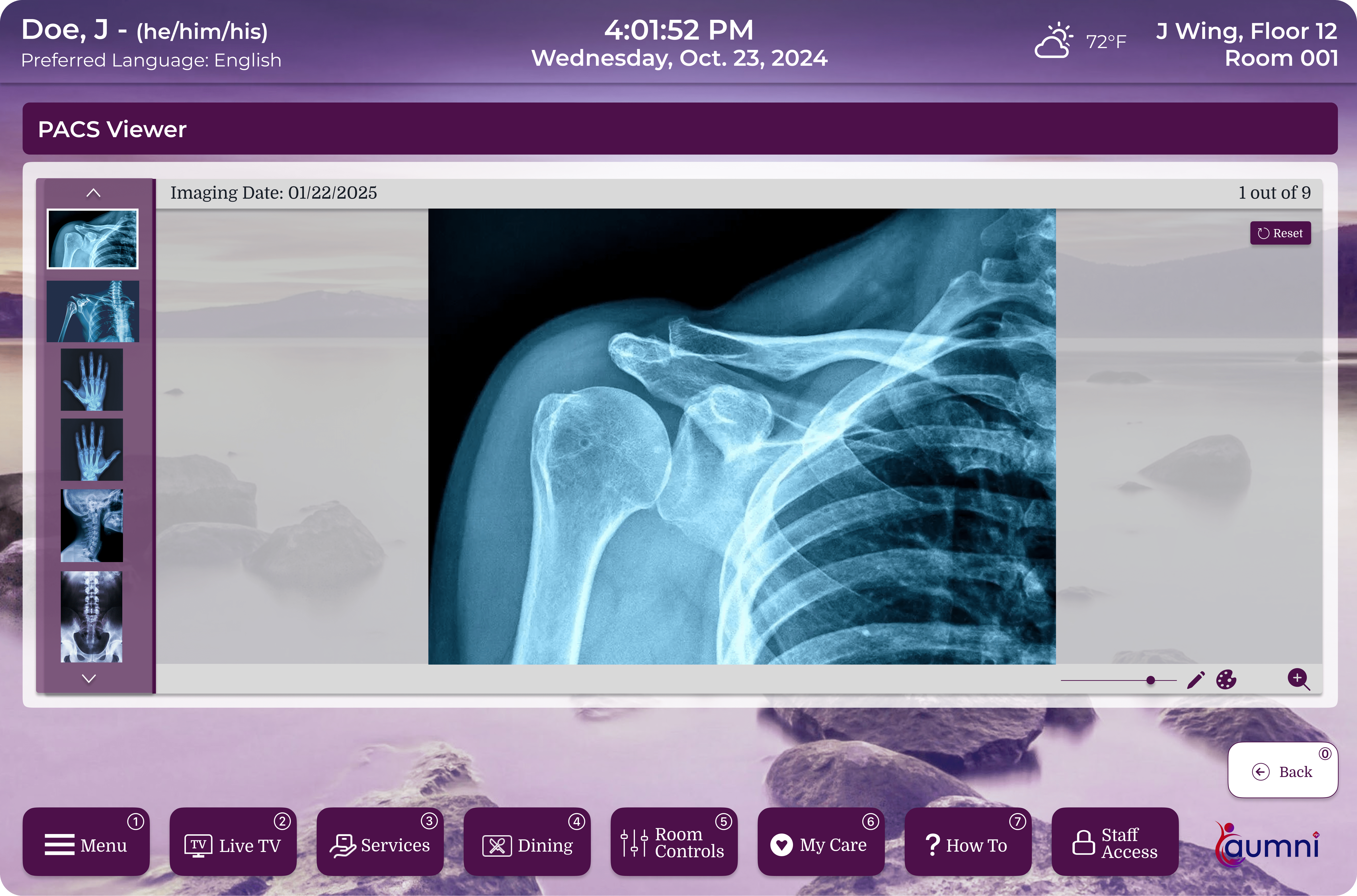 Advanced PACS Viewer